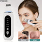 Ultrasonic Blackhead Skin Scrubber