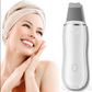 Ultrasonic Blackhead Skin Scrubber